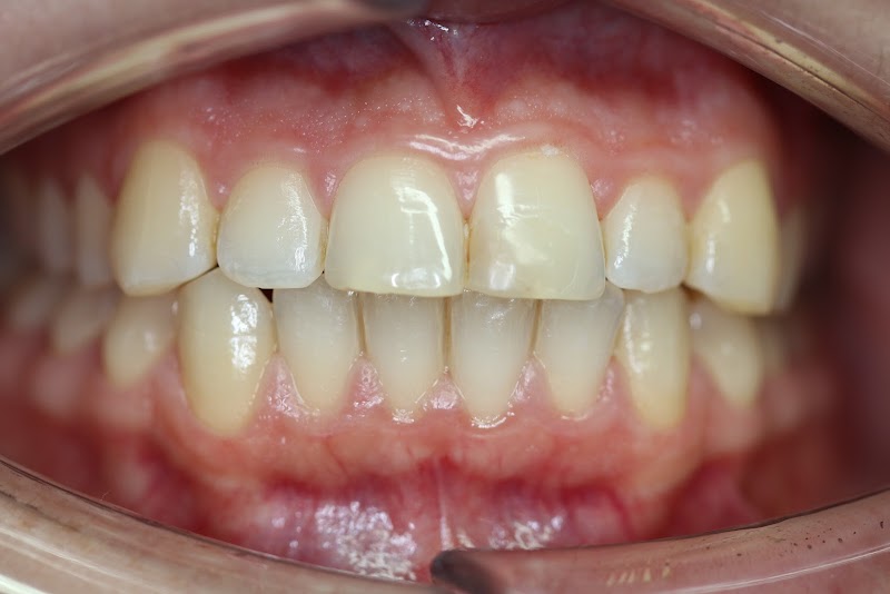 Belmont Dental Care - Dr Sreenesh Kandian & Associates