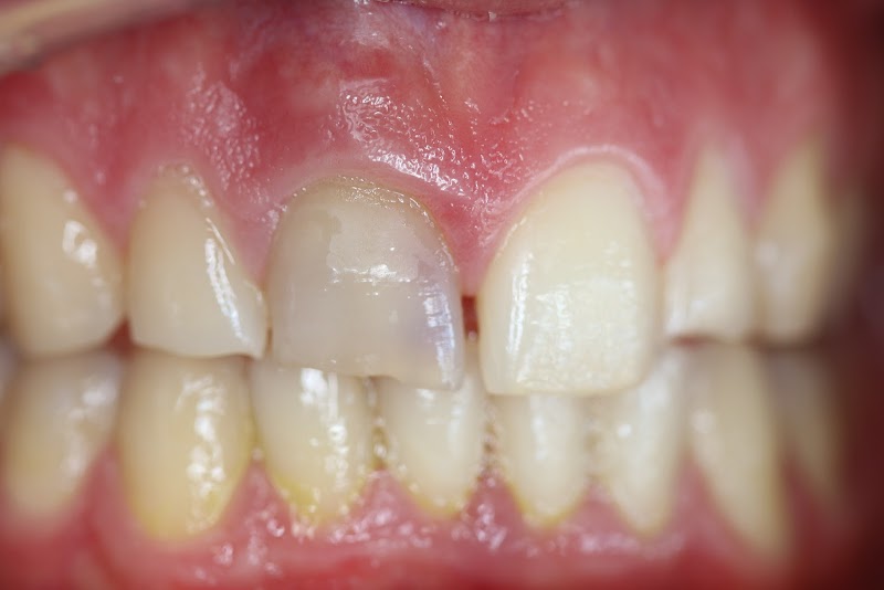 Belmont Dental Care - Dr Sreenesh Kandian & Associates