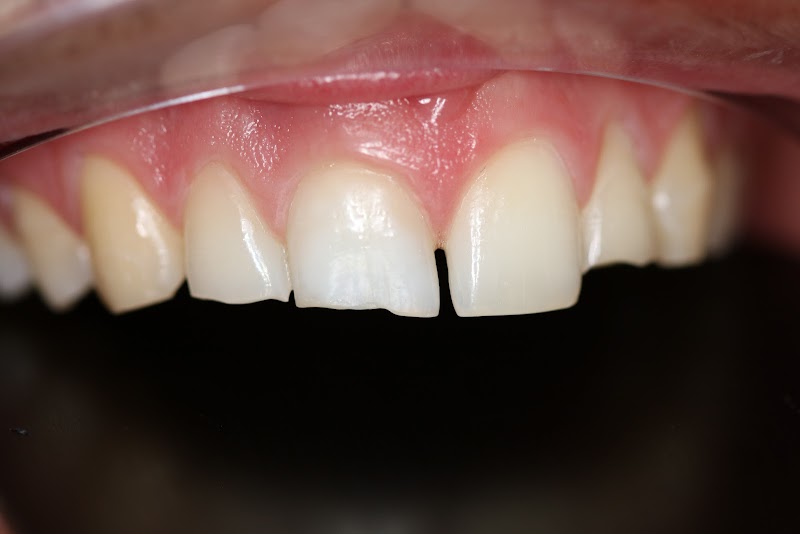 Belmont Dental Care - Dr Sreenesh Kandian & Associates