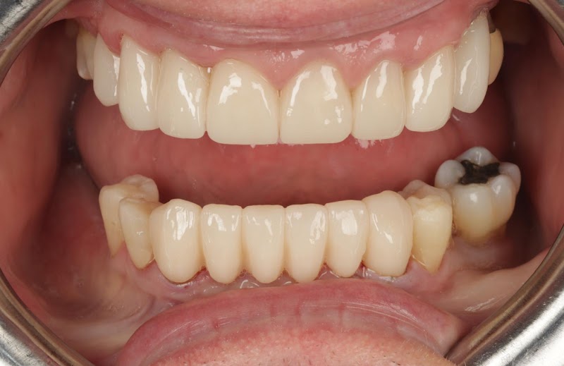 Love Teeth Dental - Sutton