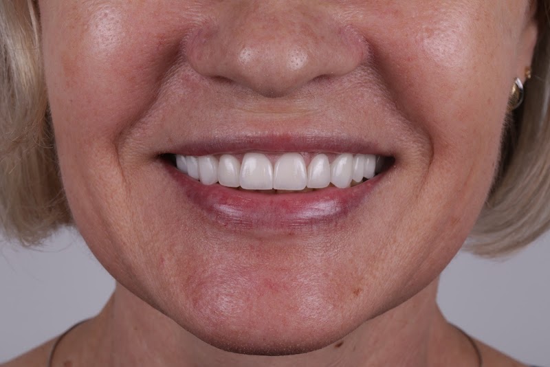 Dentico Clinic - Private Dentist in Angel, Islington