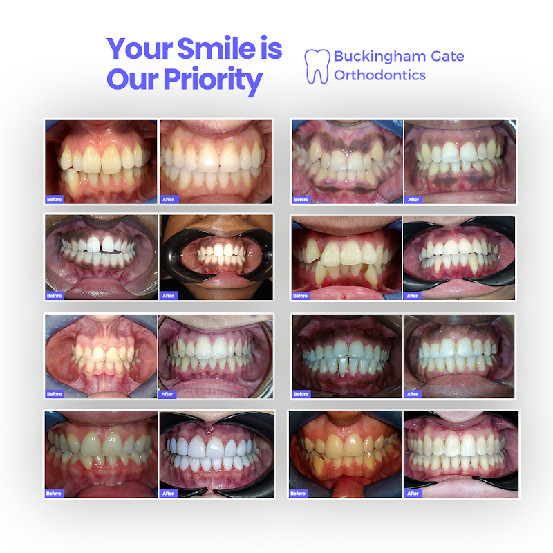 Buckingham Gate Orthodontics