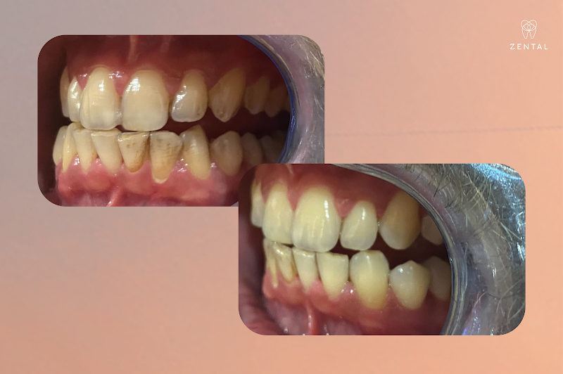 Zental Dental Cricklewood