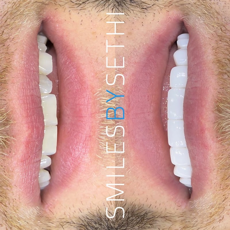 Berkeley Dental x SmilesBySethi