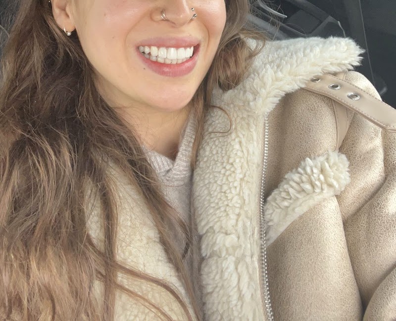 Berkeley Dental x SmilesBySethi