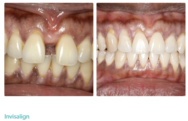 Perfect Smile - Dentist in Parsons Green