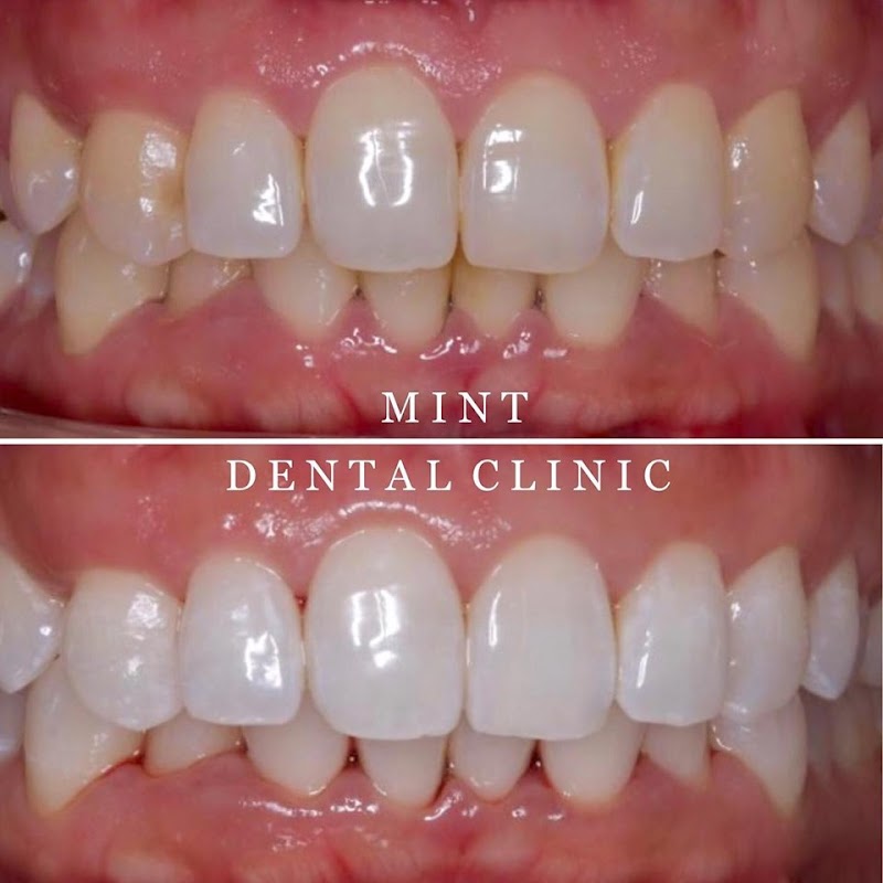 Mint Dental Clinic