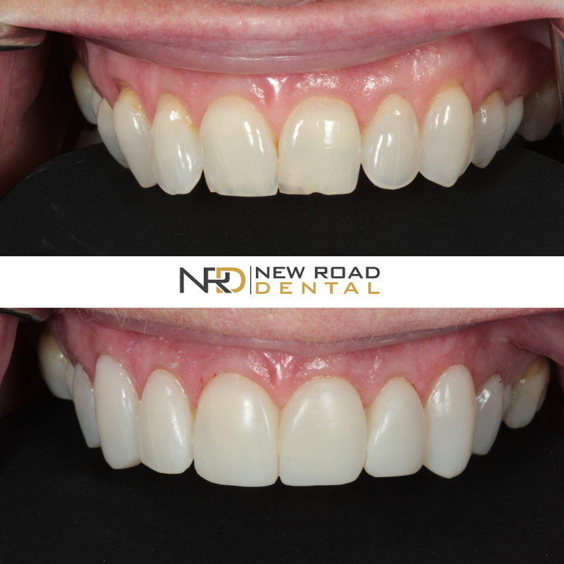 New Road Dental Practice